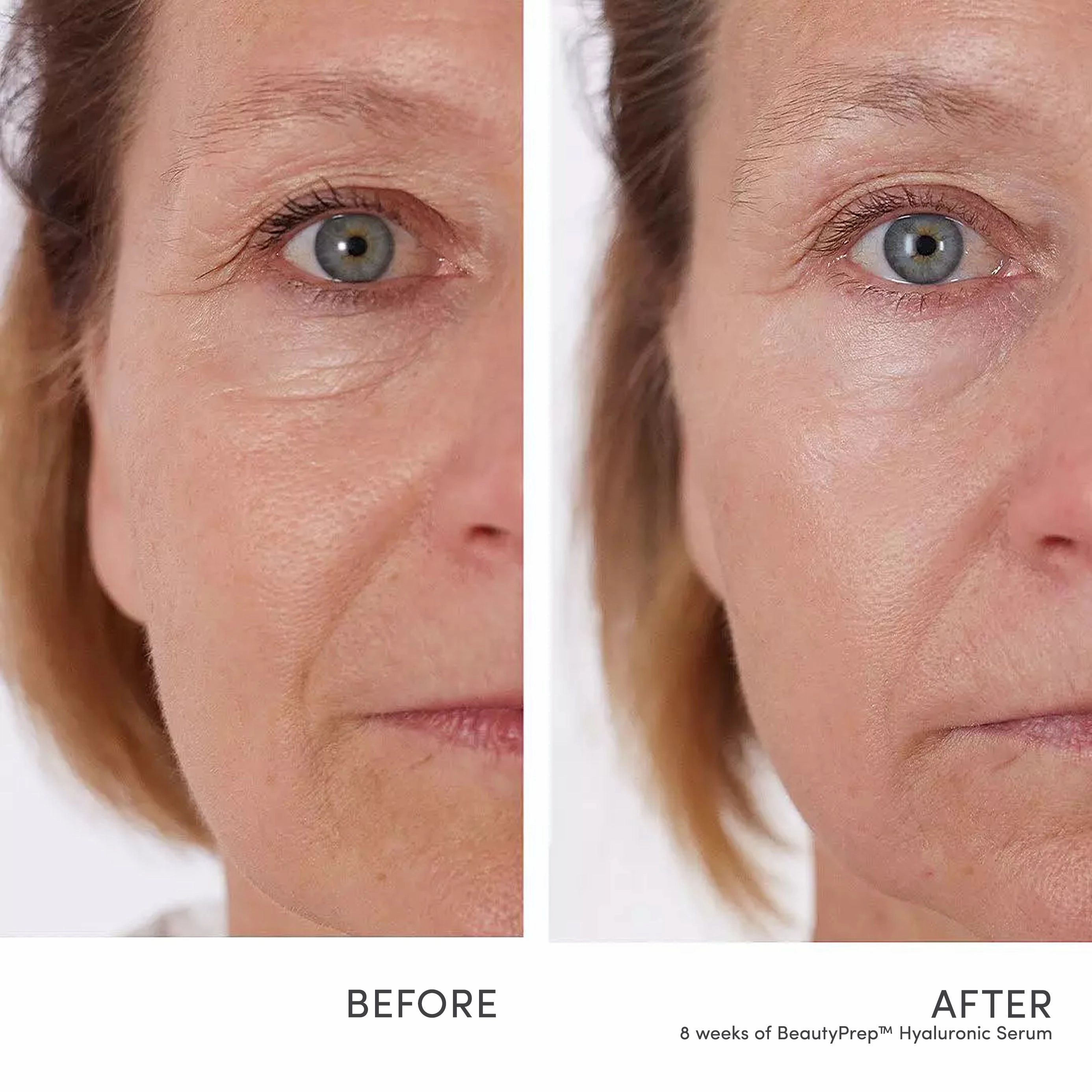 BeautyPrep™ Hyaluronic Serum